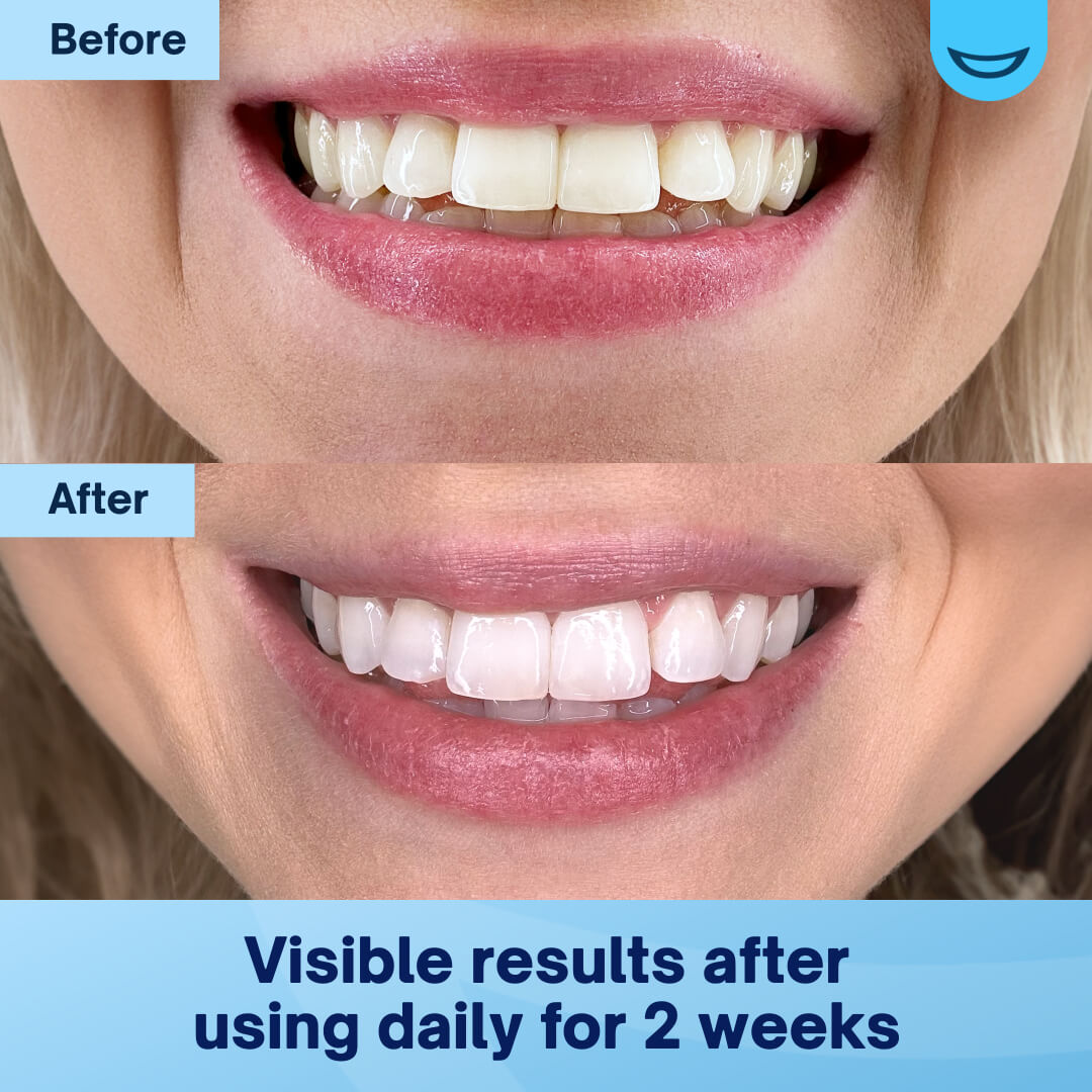 PAP Pro Teeth Whitening Powder | Subscription | Smirk PAP Pro Teeth Whitening Powder | Subscription | Smirk
