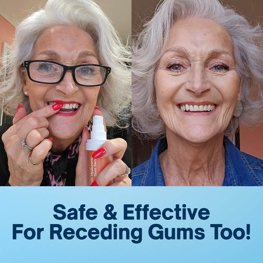 Hyaluron-Zahnfleischserum