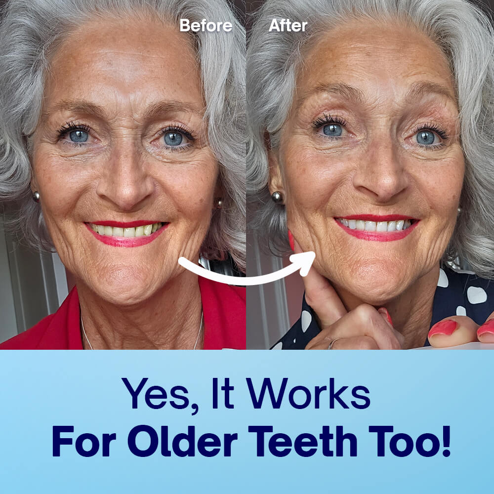 Polvo blanqueador de dientes